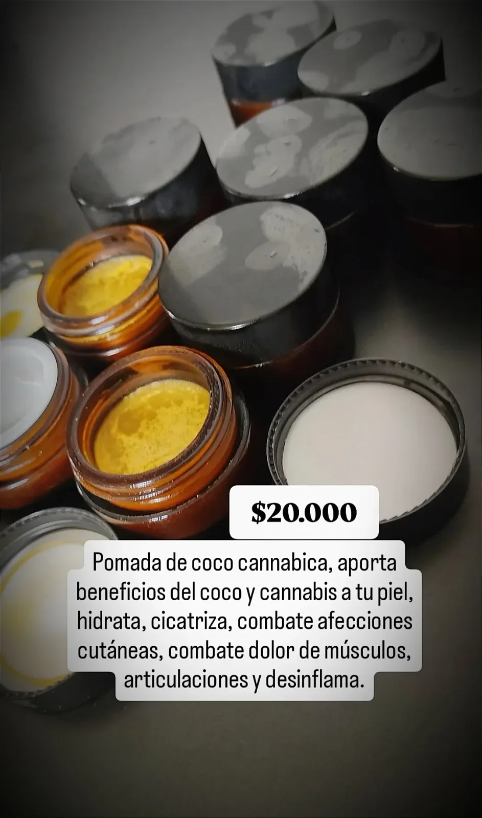 Pomada de cannabis